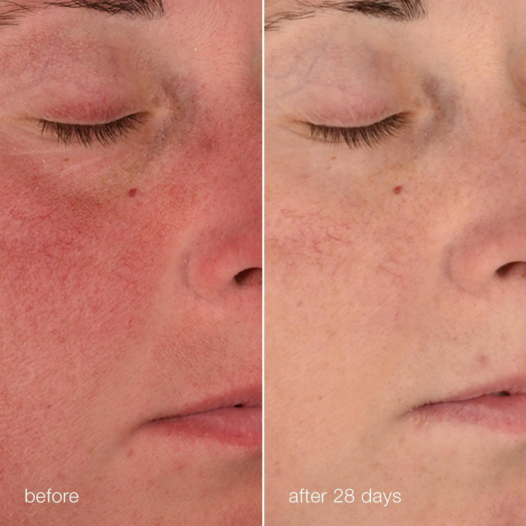 stabilizing repair cream sachet